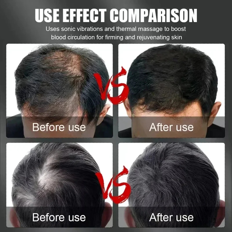 Boné Terapêutico de Luz Vermel - Hair Care avaliação e preço